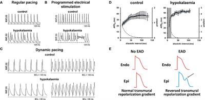 Arrhythmogenic Mechanisms in Hypokalaemia: Insights From Pre-clinical Models